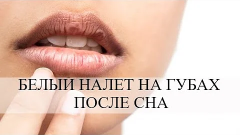 Белый налет на губах после сна: причины возникновения