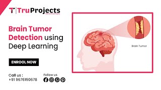 Brain Tumor Detection using Deep Learning  latest trending btech mini   major project ideas