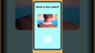 What Is This Called? ☀️ | Sunburn | English Vocabulary