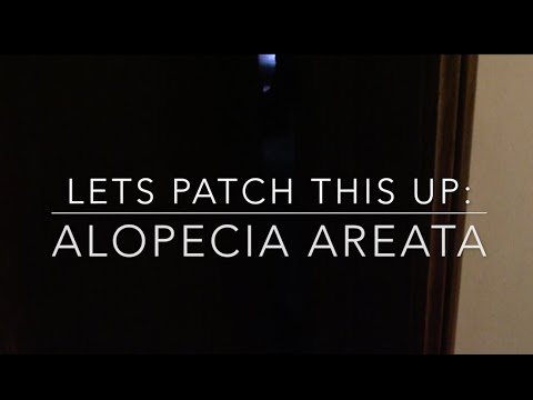 Video: Alopecia Barbae: Příčiny, Příznaky A Léčba