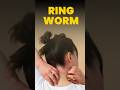 What is Ring worms ? l BIOLOGY FOR NEET l Neetwale facts l #neetpreparation l #shorts #science l