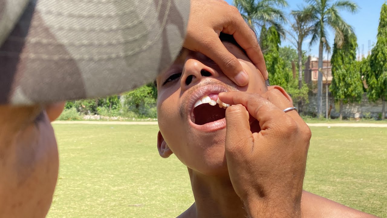 दाँतो का मेडिकल टेस्ट कैसा होता है? रीमेडिकल से बचना है विडीओ देखे INDIAN ARMY & SSC GD MEDICAL TEST