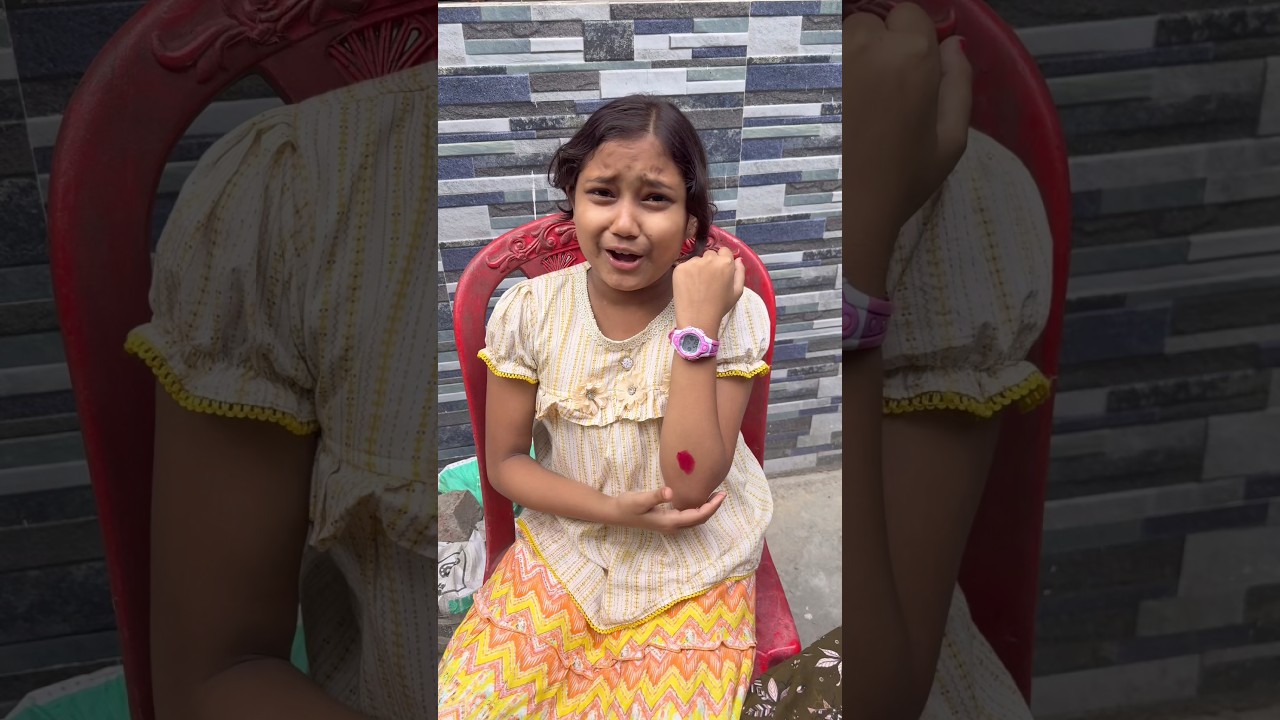 কৃপাকে ব্যান্ডেজ লাগানোর নতুন টেকনিক 😱🤣 #shorts #youtubeshorts