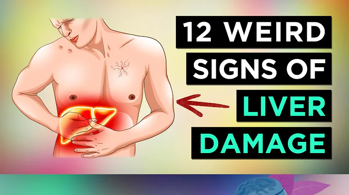 12 Weird Signs of LIVER DAMAGE - DayDayNews