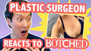 Uniboob?!?! Plastic Surgeon Reacts to BOTCHED 