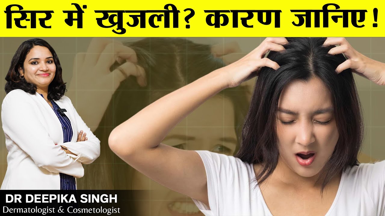 Causes of Itchy Scalp 🤔 | Scalp Itching Ke Main Karan | Doctor Explains