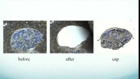 L07 RNA-seq II - NGS lecture series 2011