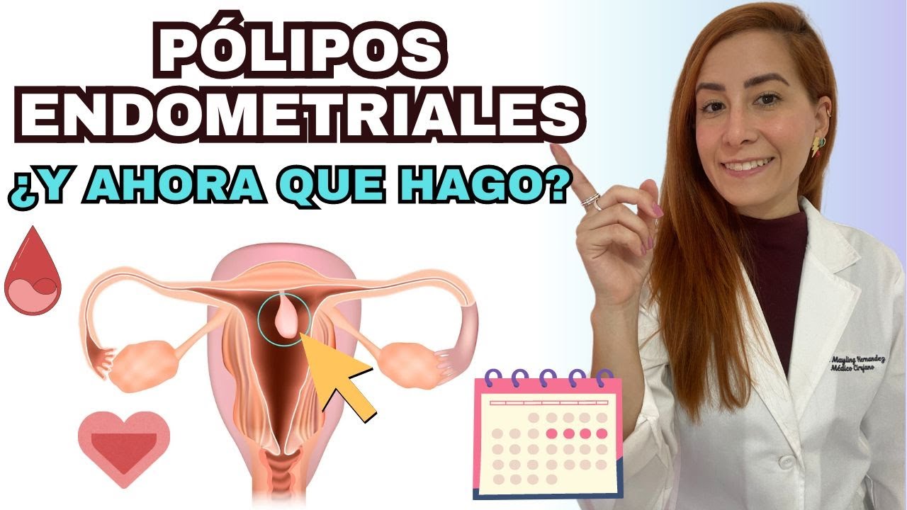 Pólipos en el útero: ¿Deberías preocuparte?