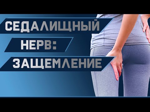 Простое упражнение для избавления от боли в СЕДАЛИЩНОМ НЕРВЕ - Поясничная ротация | Доктор Демченко