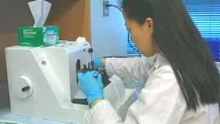 Alzheimers Disease
