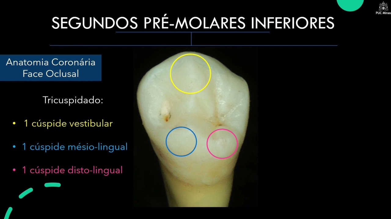 Gota #148 ANATOMIA DENTAL– Parte 6 – Pré-Molares Inferiores