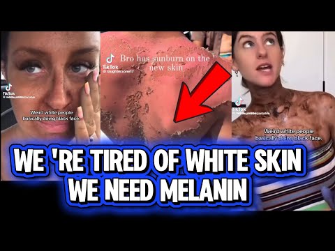 White People Now BEGGING For Melanin After Fatal Heat Wave Devastates Europe, They Hate Their Skin