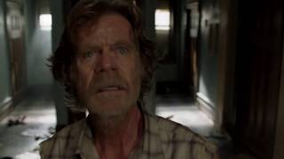 Frank Gallagher breaks his leg