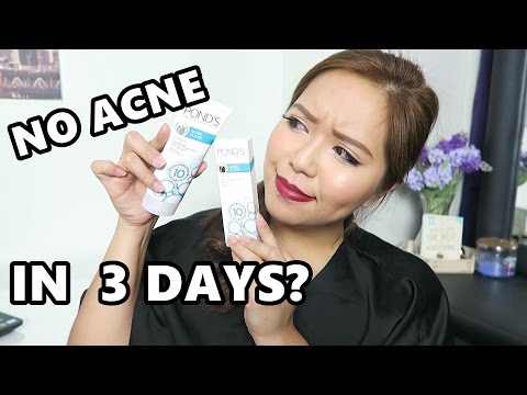 NO MORE ACNE IN 3 DAYS? (Ponds Acne Clear + GIVEAWAY) - saytioco