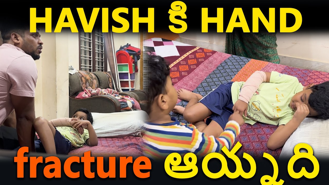 Havish కి HAND FRACTURE అయింది | Kuyya Vlogs