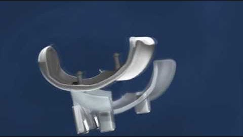 ConforMIS iFit Patient Information