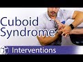 Cuboid Syndrome | Chronic Lateral Ankle Pain