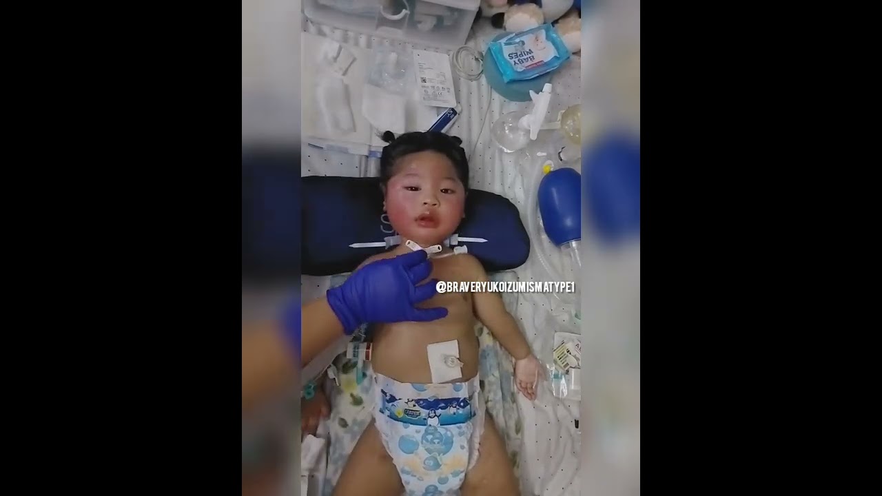 Our first Tracheostomy Tube Change at Home! YouTube