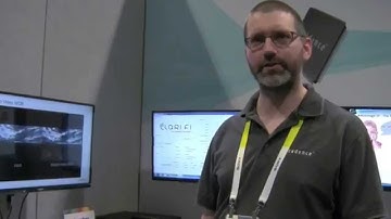 Cadence Demonstration of Face Detection