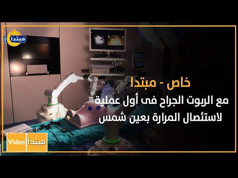 خاص مبتدا مع الربوت الجراح فى أول عملية لاستئصال المرارة بعين شمس