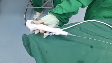 SEPLOU Ureteroscope Single-use Flexible/ urology endoscope