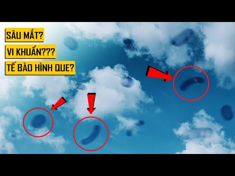 Video: Nghĩ rằng bạn biết nguyên nhân gây ra chó Bloat? Bạn có thể ngạc nhiên