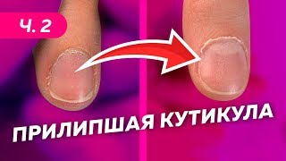 3 техники работы с налипшей кутикулой. Какую выбрать? Лайфхаки от Оксаны Глинской.