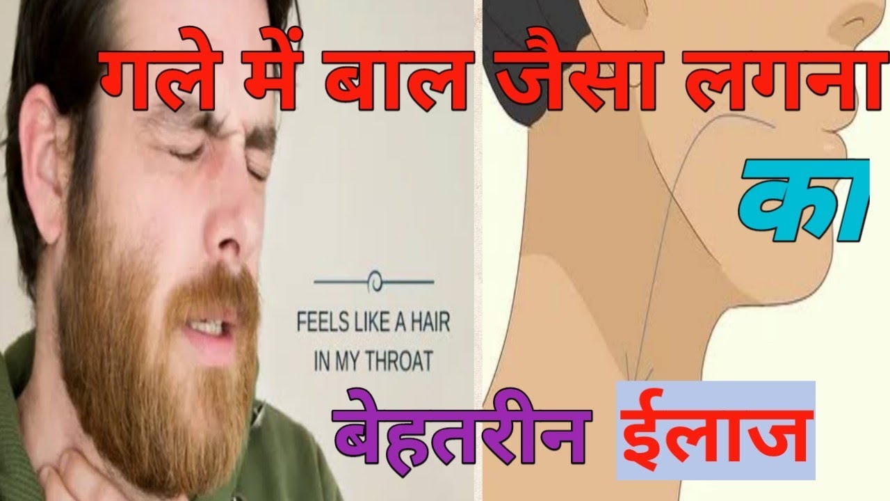 Hair sensation in throat , गले में बाल जैसा लगना , causes symptoms and