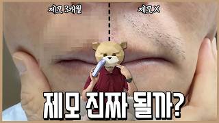 제모 되는지 한쪽수염만 3개월동안 조져 봄ㅣ내돈내산