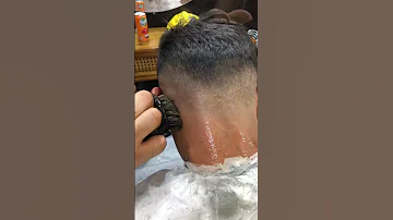 الحل السحري لي التخلص من القشرة 