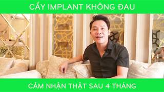 [KỂ CHUYỆN IMPLANT]: 1# Cấy implant có đau không?