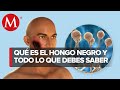 ¿Qué es el hongo Negro? Esto se sabe de la grave secuela del coronavirus