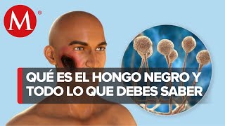 ¿Qué es el hongo Negro? Esto se sabe de la grave secuela del coronavirus