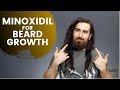 Minoxidil for Beard Growth