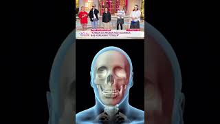 Yıllardır Yanlış Biliniyordu: Migrenin Asıl Kaynağı Ne? #haber #çağlaşıkel #gündem #sağlıklıyaşam