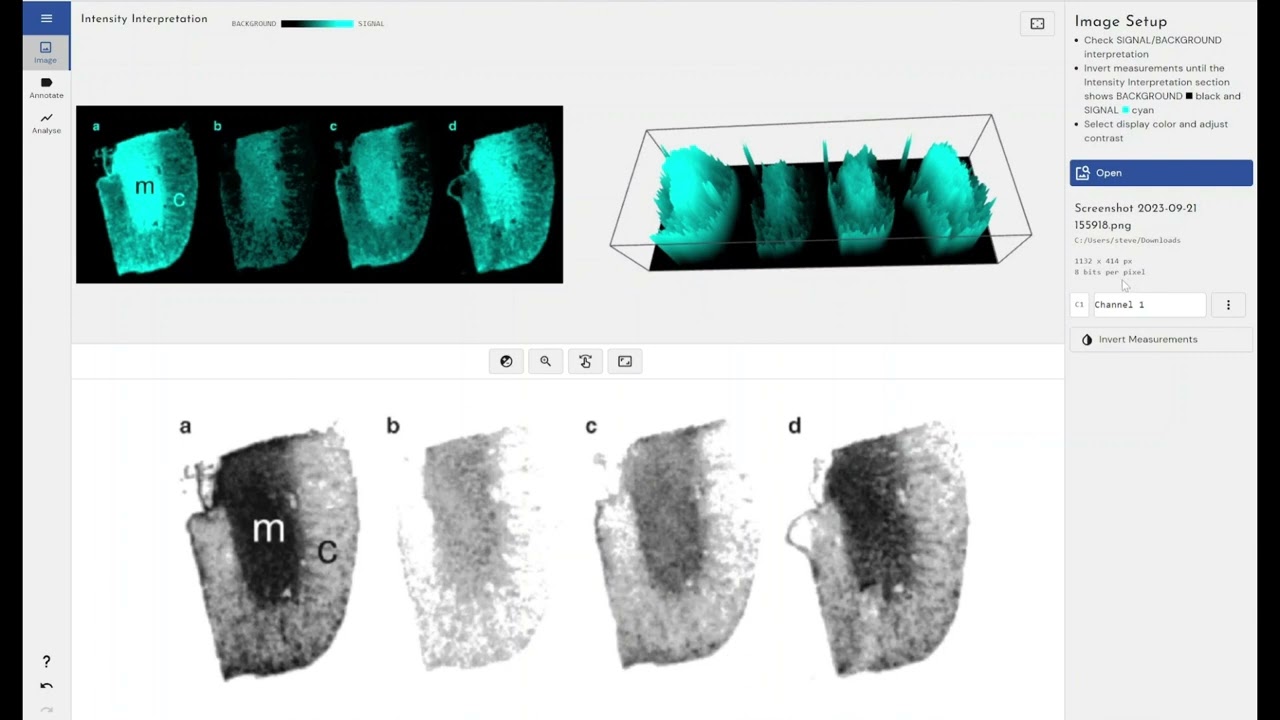 How to Analyse Phosphor/Autoradiography/PET Images With Phoretix Toolbox
