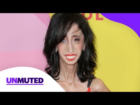 Anti-bullying activist Lizzie Velásquez on how self-love changed her life