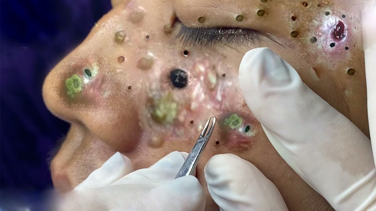 𝑅𝑒𝑐𝑙𝑎𝑖𝑚 𝑌𝑜𝑢𝑟 𝐺𝑙𝑜𝑤 𝐴𝑛𝑑 𝐶𝑎𝑙𝑚 𝑇ℎ𝑟𝑜𝑢𝑔ℎ 𝑀𝑖𝑛𝑑𝑓𝑢𝑙 𝑆𝑘𝑖𝑛𝑐𝑎𝑟𝑒 𝑀𝑜𝑚𝑒𝑛𝑡𝑠 