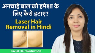 Facial Hair Removal  लेज़र हेयर रिमूवल क्या सही है? अनचाहे बालों को लेजर से किस प्रकार हटाया जाता है