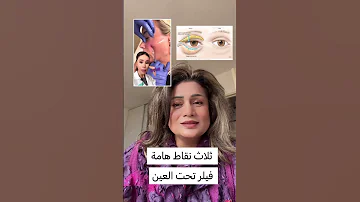فيلر تحت العين نقاط هامة يجب معرفتها قبل حقن الفيلر Beauty Anakte Antha 