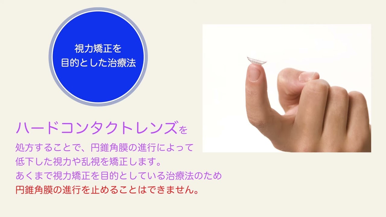 円錐角膜なら冨田実アイクリニック銀座