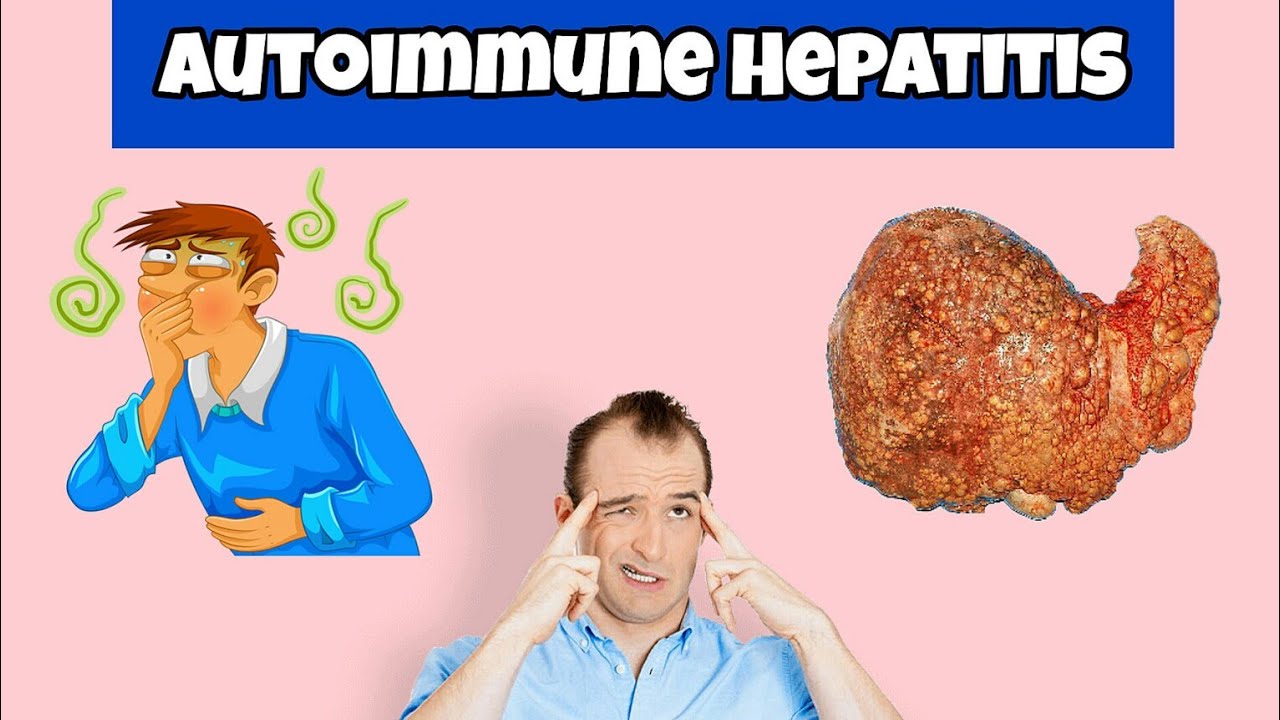 A Silent Threat 12 Warning Signs of Autoimmune Hepatitis Autoimmune