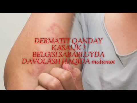 Video: Mushuklardagi Allergiya Sababli Teri Kasalliklari