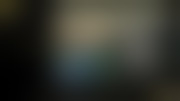 Evolution of surgical robots & widening applications