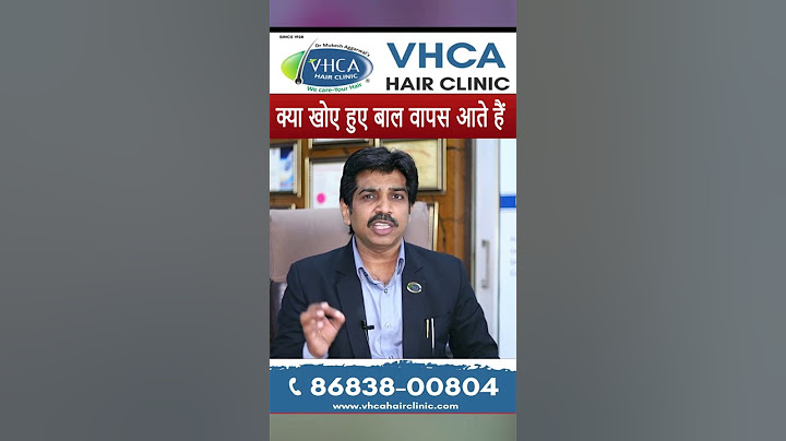 क्या खोए हुए बाल वापस आते हैं | Hair Loss Treatment | Hair Fall Solution | VHCA  Hair Clinic |