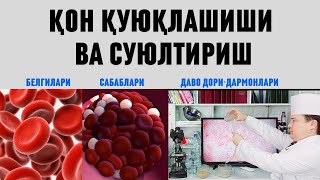 ҚОН ҚУЮҚЛАШИШИ БЕЛГИЛАРИ, САБАБЛАРИ ВА УЙ ШАРОИТИДА ДАВО ЧОРАЛАРИ / ИНФАРКТ ВА ИНСУЛЬТ ОЛДИНИ ОЛИШ