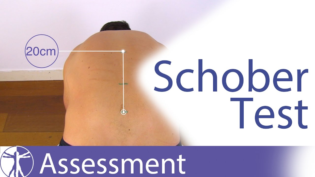 Schober Test For Lumbar Spine Flexion Youtube