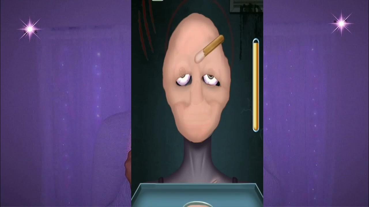 ASMR Oddly Satisfying Ear Treatment Animation Removal Blackhead, Sebum, Sebaceous Cyst In Ears