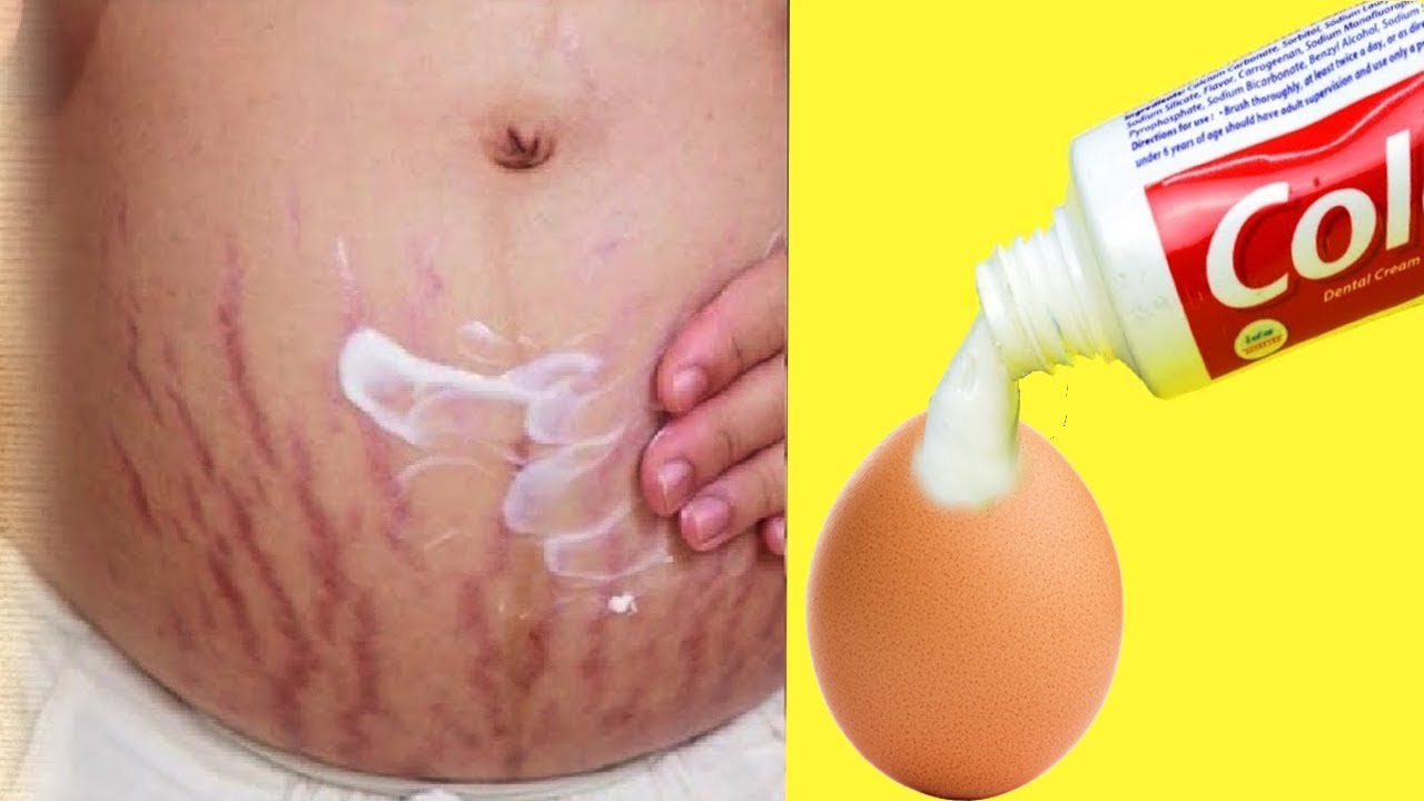 TOOTHPASTE AND EGG CLEAR ALL YOUR STRETCH IN 7 DAYSTRADITIONAL BEAUTY