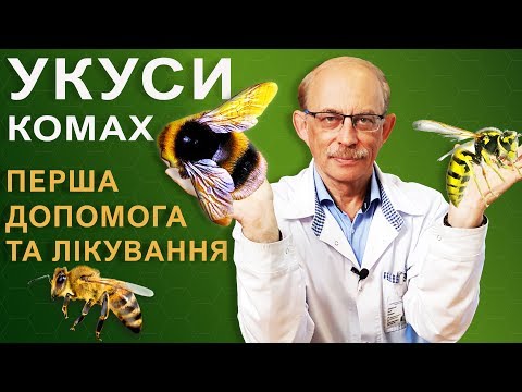 Вкусила бджола, оса, шершень або джміль - як зняти набряк, лікування, перша допомога